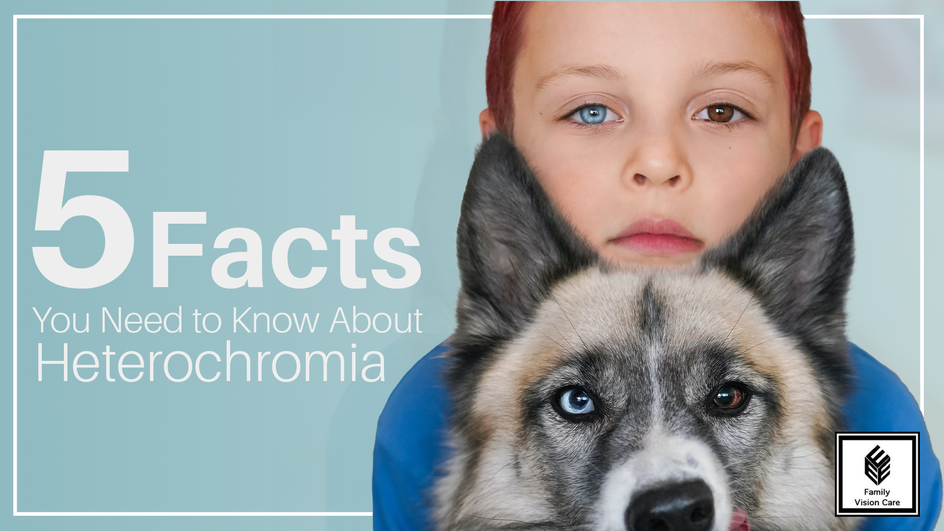 A child and a dog with heterochromia 